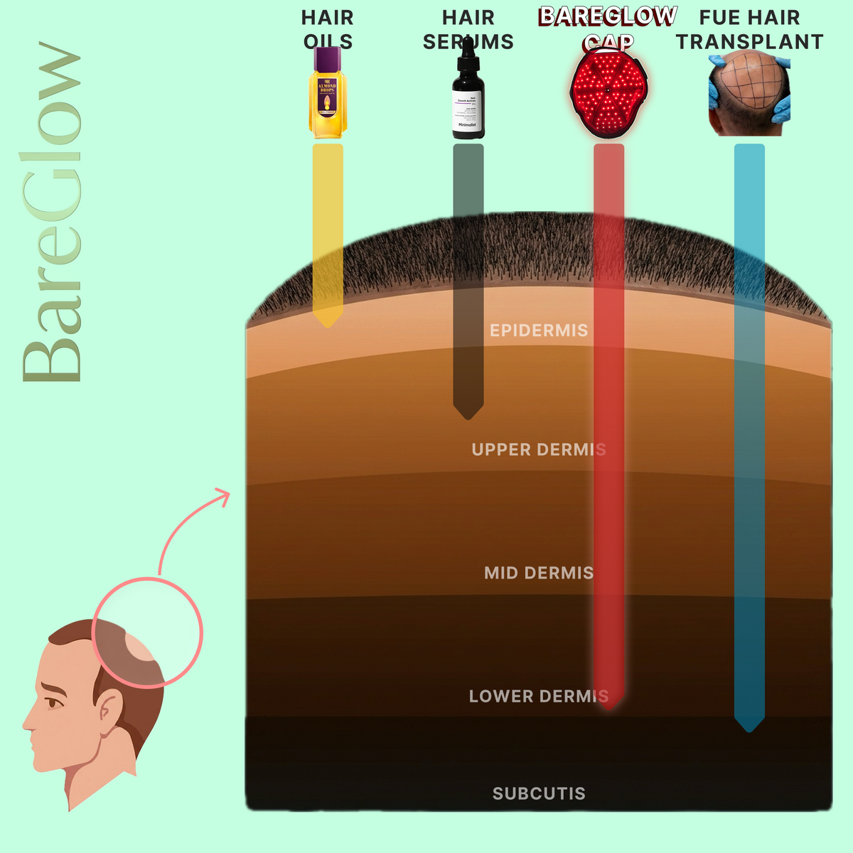 Bareglow IR (Near-Infrared) Therapy Cap | Fight Hair Loss, Regrow Thicker Hair